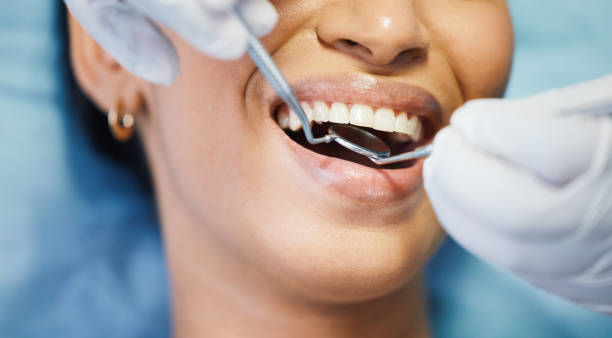 Best Emergency Dental Care for Broken or Chipped Teeth in Parchment, MI