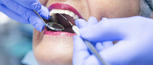 Best Emergency Tooth Extraction in Parchment, MI